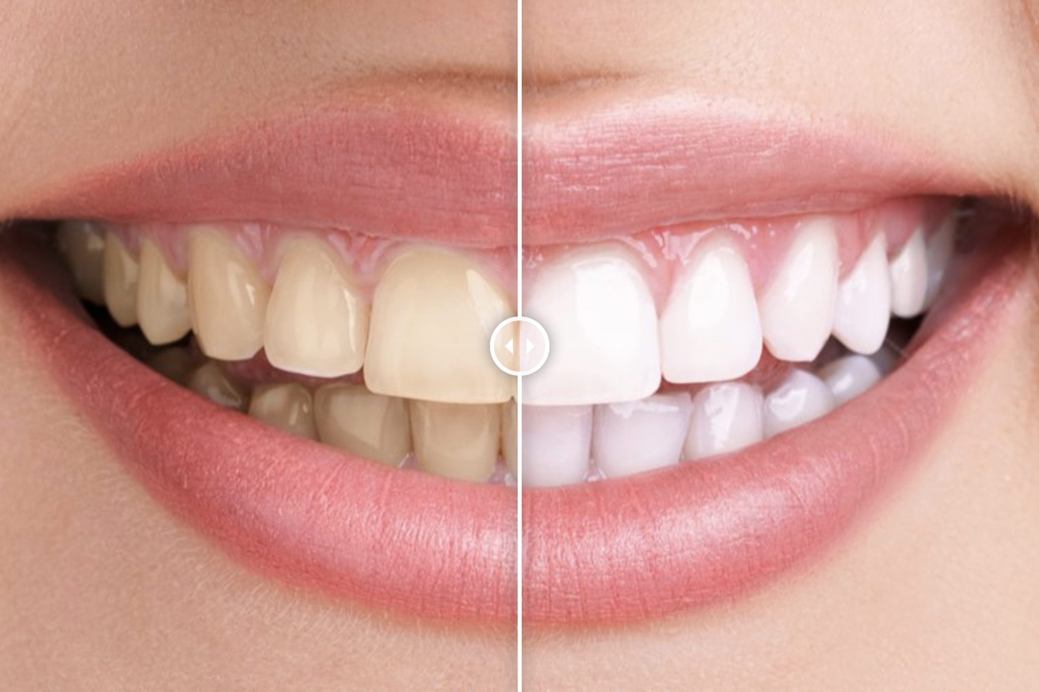 Before & After Images Comparison Wordpress Plugin